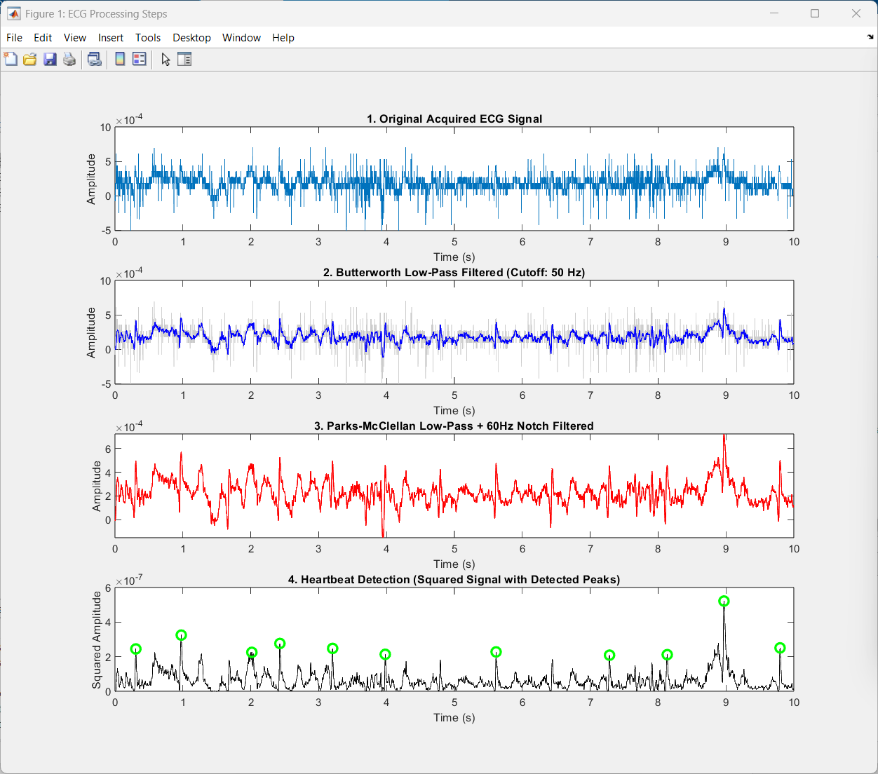 Digital Filtering and QRS Heartbeat Detection Pipeline