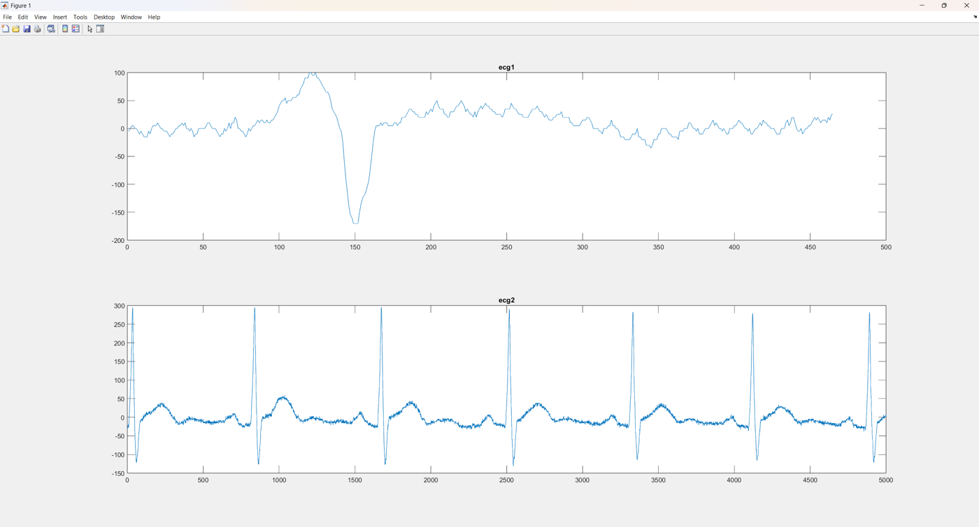 ECG Signal Acquisition and Frequency-Domain Analysis
